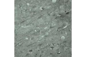 IHC on mouse brain (cryo section) using Rabbit antibody to Synaptotagmin 17  at a concentration of 50 µg/ml incubated overnight at 4C. (SYT17 Antikörper  (Internal Region))