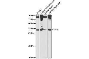 Western blot analysis of extracts of various cell lines, using MYF6 antibody (ABIN6291680) at 1:1000 dilution. (MYF6 Antikörper)