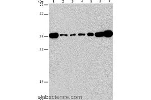 Western blot analysis of Lovo, A431, A549, hela, hepG2 and Raji cell, mouse brain tissue, using CRKL Polyclonal Antibody at dilution of 1:550 (CrkL Antikörper)