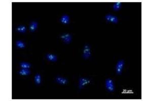 Immunostaining analysis in HeLa cells. (RPF2 Antikörper)
