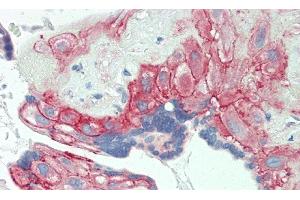 Immunohistochemistry (IHC) image for anti-CD276 (CD276) (AA 47-219) antibody (ABIN7432586)