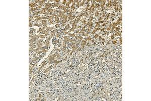 IHC analysis of LIPC using anti-LIPC antibody (ABIN7601582). (LIPC Antikörper  (AA 39-494))