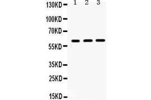 Western Blotting (WB) image for anti-HNF1 Homeobox B (HNF1B) (AA 496-525), (C-Term) antibody (ABIN3042452) (HNF1B Antikörper  (C-Term))
