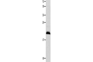 Western Blotting (WB) image for anti-Fibroblast Growth Factor 12 (FGF12) antibody (ABIN2427846) (FGF12 Antikörper)