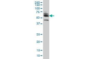 ZNF345 monoclonal antibody (M01), clone 6G10 Western Blot analysis of ZNF345 expression in HeLa . (ZNF345 Antikörper  (AA 1-111))