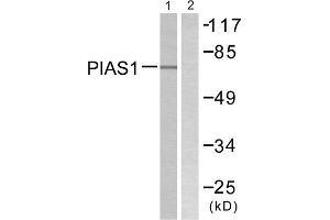 Western blot analysis of extracts from MDA-MB-435 cells, using PIAS1 antibody. (PIAS1 Antikörper  (N-Term))