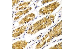 Immunohistochemistry of paraffin-embedded Human gastric using ABO antibody at dilution of 1:100 (x400 lens). (ABO Antikörper)