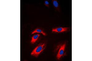 Immunofluorescent analysis of Creatine Kinase M staining in NIH3T3 cells. (CKM Antikörper  (N-Term))
