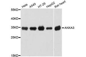 Western blot analysis of extracts of various cell lines, using ANXA3 antibody. (Annexin A3 Antikörper  (AA 1-323))