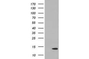 HEK293T cells were transfected with the pCMV6-ENTRY control (Left lane) or pCMV6-ENTRY RIPPLY2 (Right lane) cDNA for 48 hrs and lysed. (RIPPLY2 Antikörper)