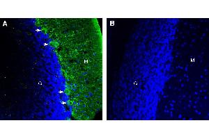 Expression of DSCAM in rat cerebellum.