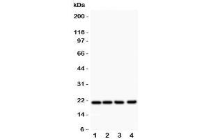 Western blot testing of DHFR antibody and Lane 1:  rat liver (Dihydrofolate Reductase Antikörper  (AA 2-187))