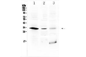 Western blot analysis of HOXB1 using anti-HOXB1 antibody . (HOXB1 Antikörper  (C-Term))