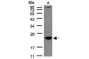 WB Image Sample(30 μg of whole cell lysate) A:Raji, 12% SDS PAGE antibody diluted at 1:1500 (TMEM147 Antikörper)