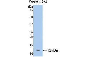Western blot analysis of the recombinant protein. (Prohibitin Antikörper  (AA 177-272))