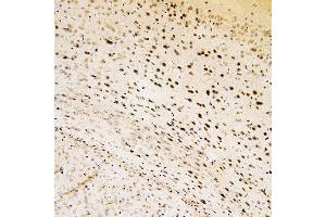 IHC analysis of SOX15 using anti-SOX15 antibody (ABIN6719624).