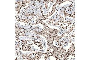 IHC analysis of SNRNP40 using anti-SNRNP40 antibody (ABIN7601719). (SNRNP40 Antikörper  (AA 43-357))