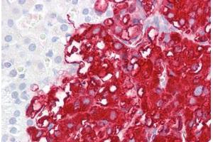 Anti-TPH1 / TPH antibody IHC staining of adrenal.