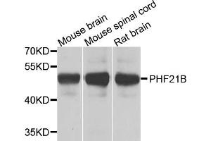 Western blot analysis of extracts of various cells, using PHF21B antibody. (PHF21B Antikörper)