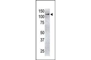 The anti-USP4 C-term Pab (ABIN388883 and ABIN2839175) is used in Western blot to detect USP4 in USP4-transfected HeLa cell lysate. (USP4 Antikörper  (C-Term))