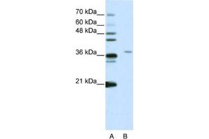 Western Blotting (WB) image for anti-Squamous Cell Carcinoma Antigen Recognized By T Cells 3 (SART3) antibody (ABIN2461855) (SART3 Antikörper)