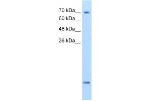 WB Suggested Anti-SLC6A8 Antibody Titration:  2.