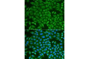 Immunofluorescence analysis of U2OS cells using PIP antibody (ABIN6131693, ABIN6145670, ABIN6145672 and ABIN6222022). (PIP Antikörper  (AA 29-146))