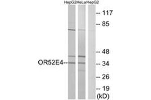 Western blot analysis of extracts from HepG2/HeLa cells, using OR52E4 Antibody. (OR52E4 Antikörper  (AA 200-249))