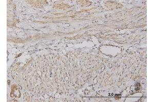 Immunoperoxidase of monoclonal antibody to CXCL5 on formalin-fixed paraffin-embedded human smooth muscle. (CXCL5 Antikörper  (AA 1-114))