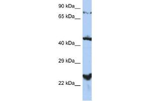 WB Suggested Anti-MRS2L Antibody Titration:  0. (MRS2 Antikörper  (Middle Region))