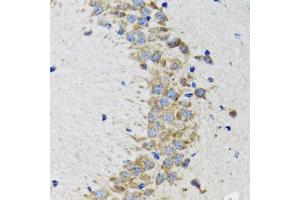 Immunohistochemistry of paraffin-embedded rat brain using CDK1 antibody. (CDK1 Antikörper)