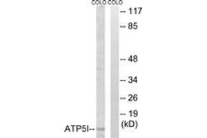 Western Blotting (WB) image for anti-ATP Synthase, H+ Transporting, Mitochondrial F0 Complex, Subunit E (ATP5I) (AA 20-69) antibody (ABIN2890139) (ATP5I Antikörper  (AA 20-69))