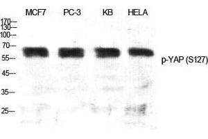 Western Blot (WB) analysis of specific cells using Phospho-YAP (S127) Polyclonal Antibody. (YAP1 Antikörper  (pSer127))