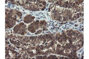 Immunohistochemistry (IHC) image for anti-Myeloid Leukemia Factor 1 (MLF1) antibody (ABIN1499496) (MLF1 Antikörper)