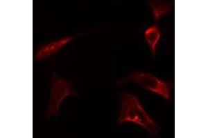 ABIN6278128 staining LOVO cells by IF/ICC. (HSPA14 Antikörper)