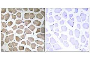 Immunohistochemistry analysis of paraffin-embedded human skeletal muscle tissue using MOT12 Antibody . (SLC16A12 Antikörper)