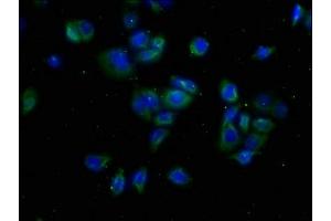 Immunofluorescence staining of PC-3 cells with ABIN7175608 at 1:50, counter-stained with DAPI. (CACNA1A Antikörper  (AA 1838-2136))