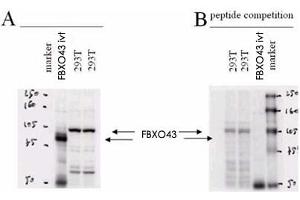 Western blot using FBXO43 polyclonal antibody . (FBXO43 Antikörper  (N-Term))