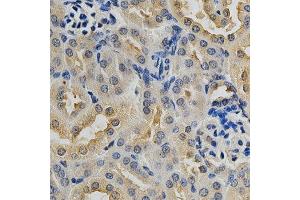 Immunohistochemistry (IHC) image for anti-Mitogen-Activated Protein Kinase 10 (MAPK10) (AA 175-464) antibody (ABIN3022948)
