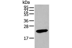 Western blot analysis of Human stomach tissue lysate using GKN1 Polyclonal Antibody at dilution of 1:250 (Gastrokine 1 Antikörper)