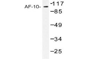 Western blot (WB) analysis of AF-10 antibody in extracts from COLO205 cells. (MLLT10 Antikörper)