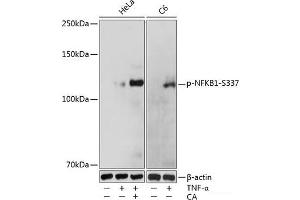 Western Blotting (WB) image for anti-Nuclear Factor of kappa Light Polypeptide Gene Enhancer in B-Cells 1 (NFKB1) (pSer337) antibody (ABIN7265102)