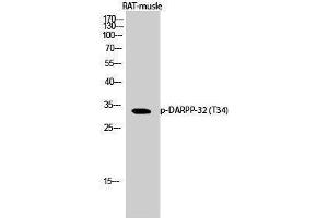 Western Blotting (WB) image for anti-Protein Phosphatase 1, Regulatory (Inhibitor) Subunit 1B (PPP1R1B) (pThr34) antibody (ABIN3182827) (DARPP32 Antikörper  (pThr34))