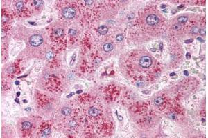 Immunohistochemistry (IHC) image for anti-Wingless-Type MMTV Integration Site Family, Member 11 (WNT11) (Internal Region) antibody (ABIN1049471)