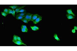 Immunofluorescent analysis of HepG2 cells using ABIN7169459 at dilution of 1:100 and Alexa Fluor 488-congugated AffiniPure Goat Anti-Rabbit IgG(H+L) (STAC Antikörper  (AA 1-119))