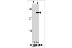 Western blot analysis of ARF5 using rabbit polyclonal ARF5 Antibody using 293 cell lysates (2 ug/lane) either nontransfected (Lane 1) or transiently transfected (Lane 2) with the ARF5 gene.