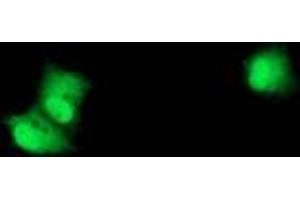 Anti-RPS6KB1 mouse monoclonal antibody (ABIN2454594) immunofluorescent staining of COS7 cells transiently transfected by pCMV6-ENTRY RPS6KB1 (RC217324). (RPS6KB1 Antikörper)
