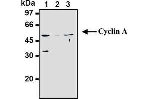 Western Blotting (WB) image for anti-Cyclin A2 (CCNA2) antibody (ABIN567779) (Cyclin A Antikörper)