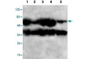 Western blot analysis of PPP2CB monoclonal antibody  at 1:1000 dilution. (PPP2CB Antikörper  (C-Term))