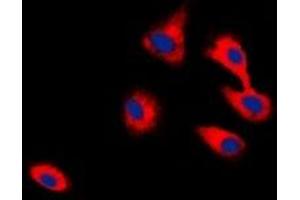 Immunofluorescent analysis of CADM2 staining in HepG2 cells. (CADM2 Antikörper)